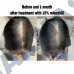 Traitement de la repousse des cheveux 15% Alopécie Perte de cheveux Croissance des cheveux 30ml 50ml
